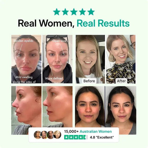 Golden Root Lymphatic Drainage Cleanse